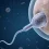 Sperm DNA